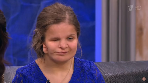 17-летняя героиня шоу «Пусть говорят» с деформацией лица скончалась после пластической операции