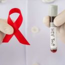 Тюменцы смогут анонимно узнать свой ВИЧ-статус