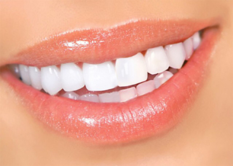 Возвращение улыбки: что делать, когда зубов нет совсем